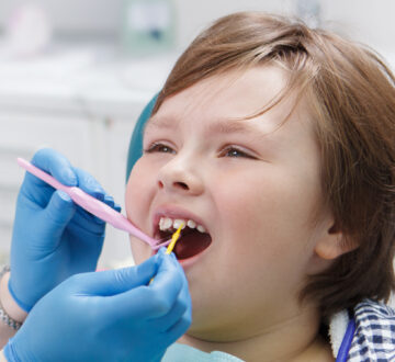 Top Benefits of Professional Fluoride Treatments for Stronger Teeth